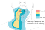 Bridging the Gap: How 3D Printing is Personalizing Head and Neck Cancer Care